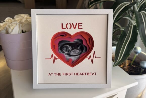 Ultrasound Photo Frame - 3D Shadow Box: A Unique Way to Display Memories
